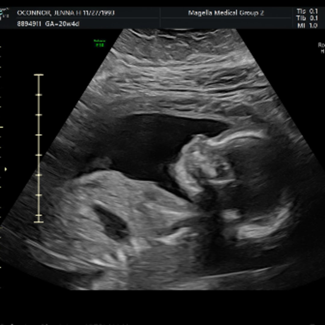 Photo shared by Jenna for their Babylist baby registry.