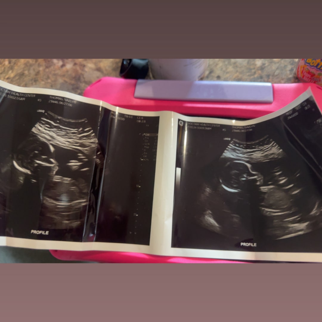 Photo shared by Nazlyn for their Babylist baby registry.