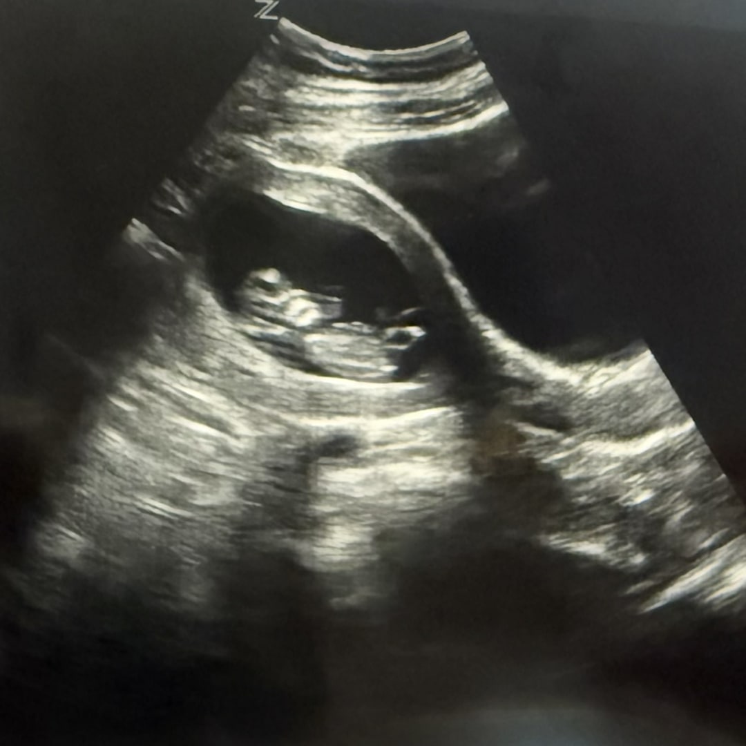 Photo shared by Desiree for their Babylist baby registry.