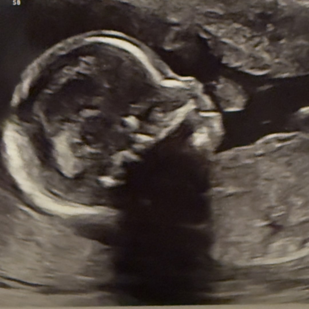 Photo shared by Tressa for their Babylist baby registry.
