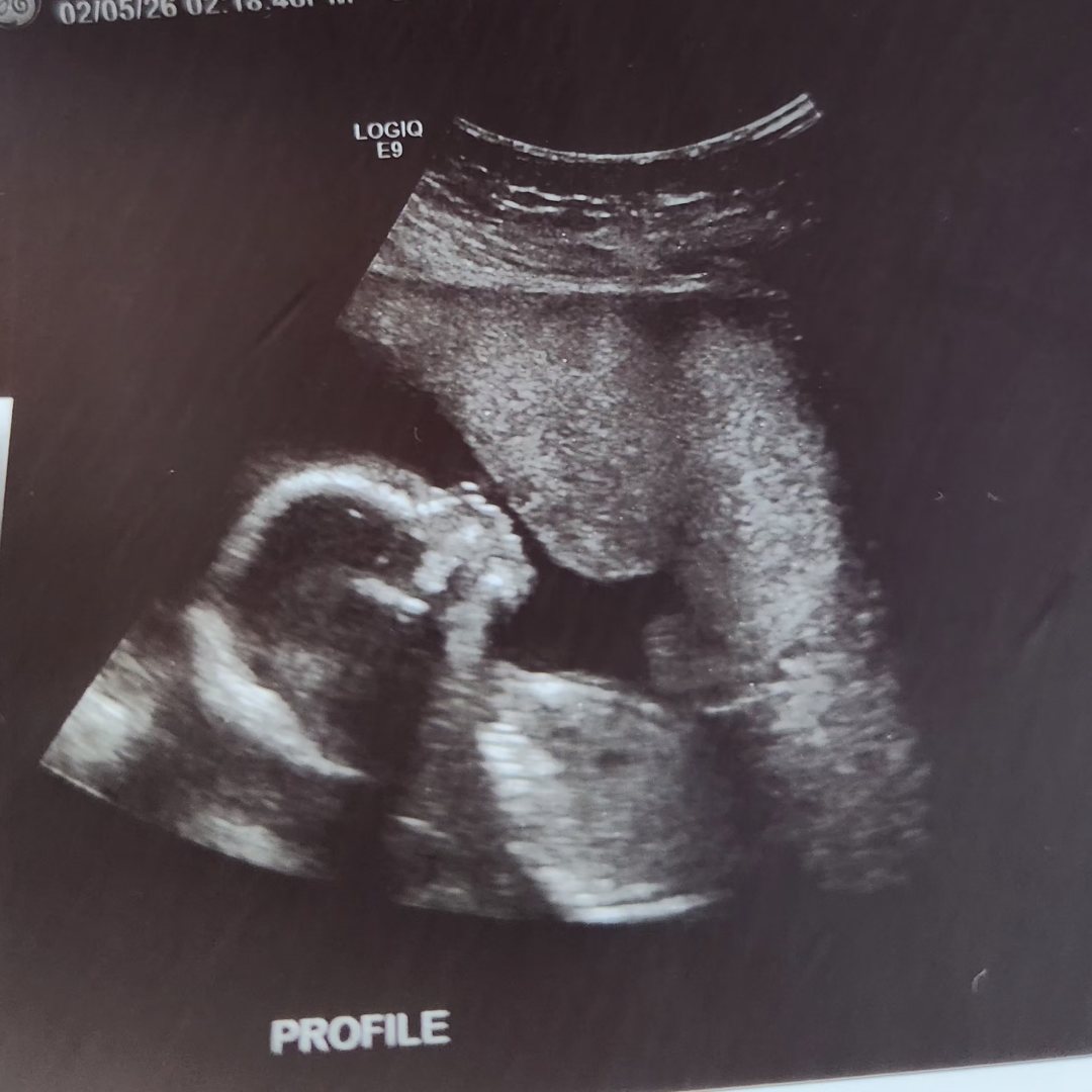 Photo shared by Daiana for their Babylist baby registry.