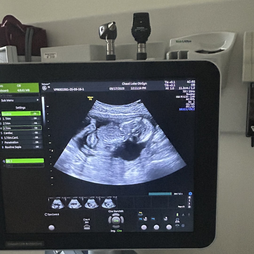 Photo shared by Dililah for their Babylist baby registry.
