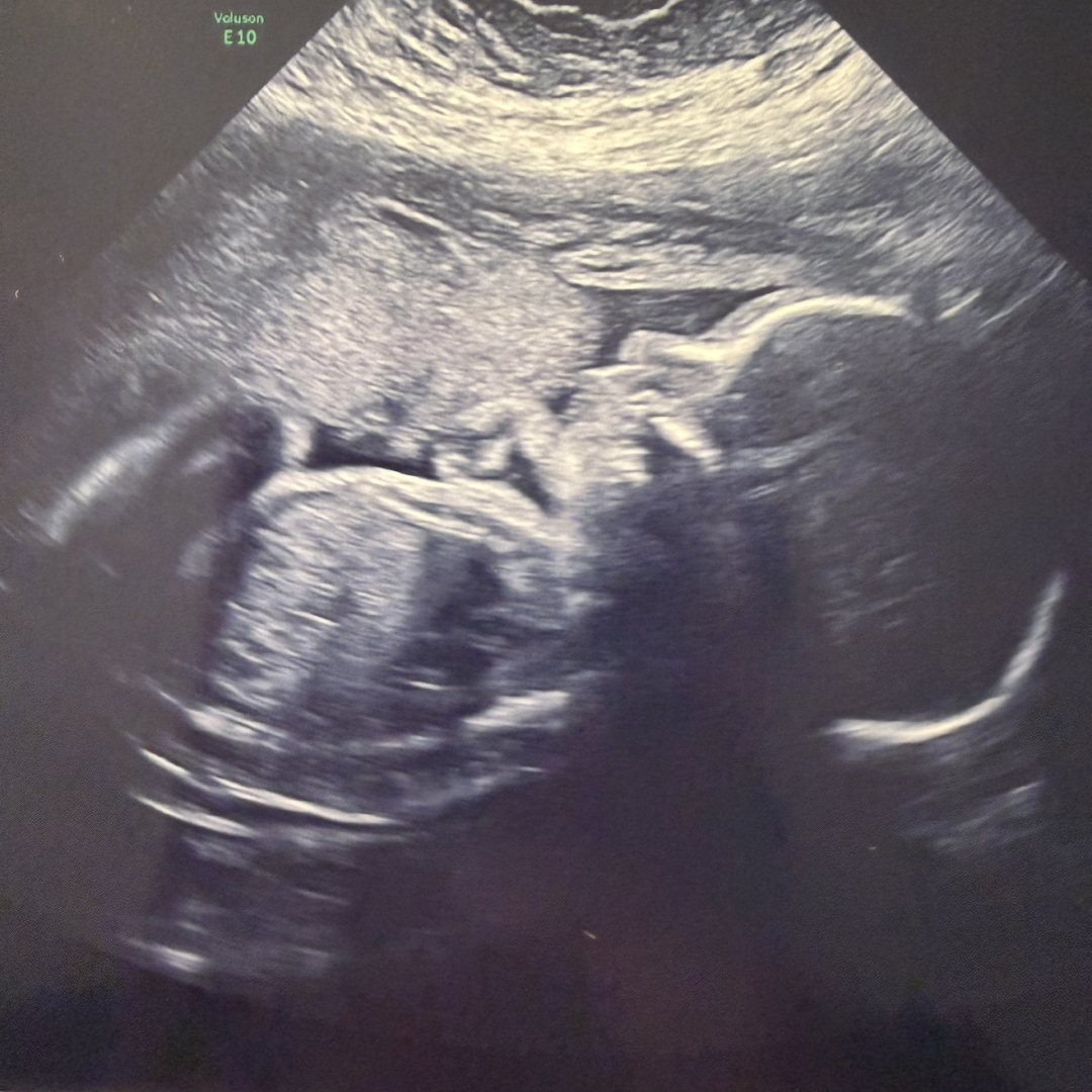 Photo shared by Megan for their Babylist baby registry.