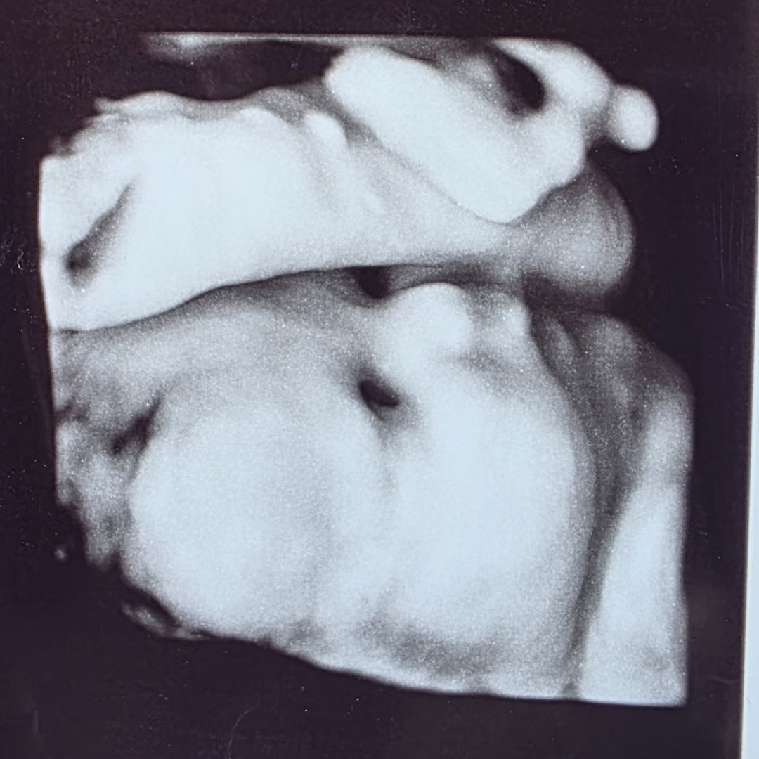 Photo shared by Madison for their Babylist baby registry.