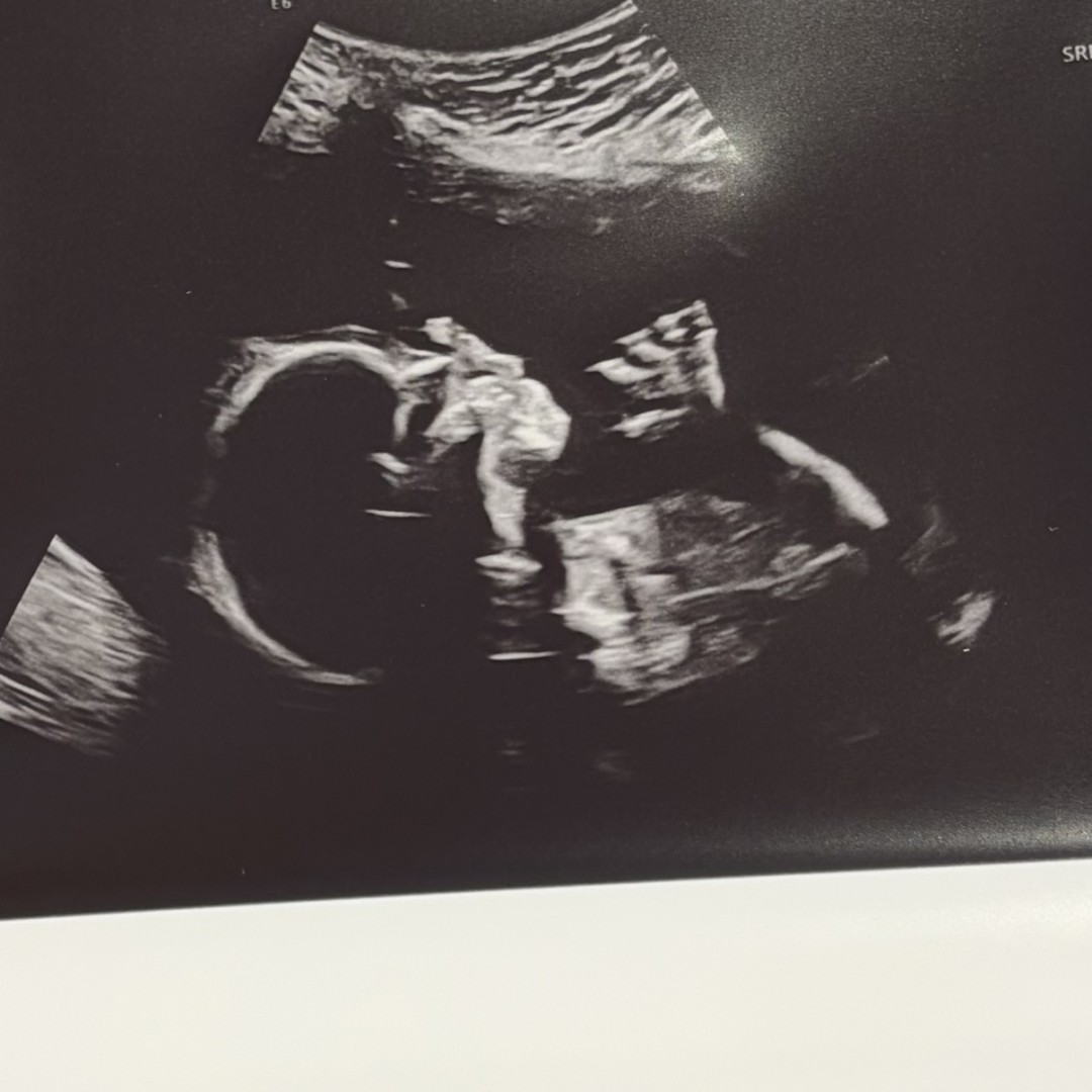 Photo shared by Haley for their Babylist baby registry.