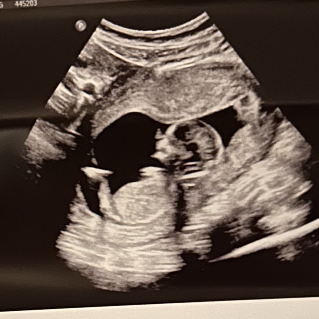 Photo shared by Emmah for their Babylist baby registry.