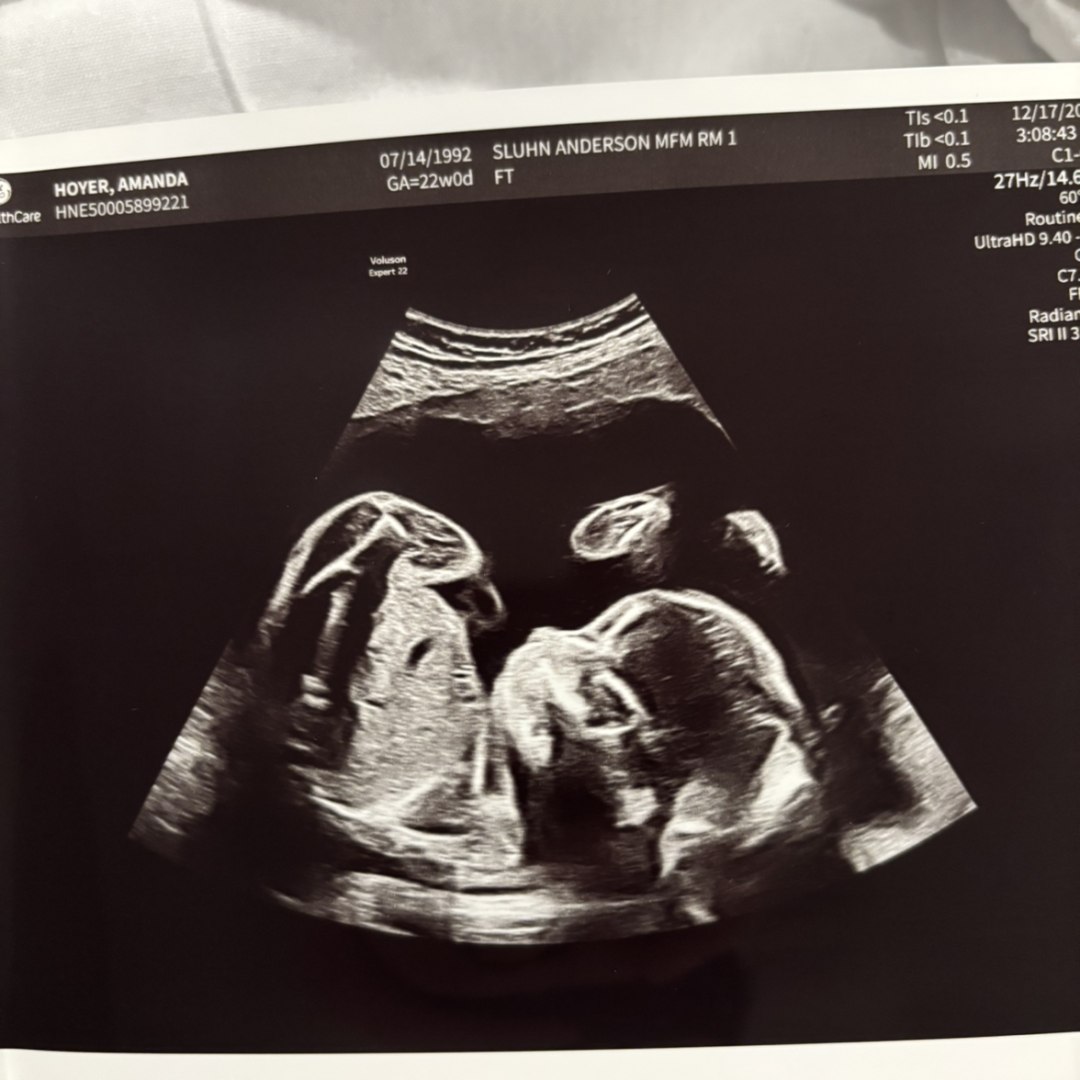 Photo shared by Amanda for their Babylist baby registry.