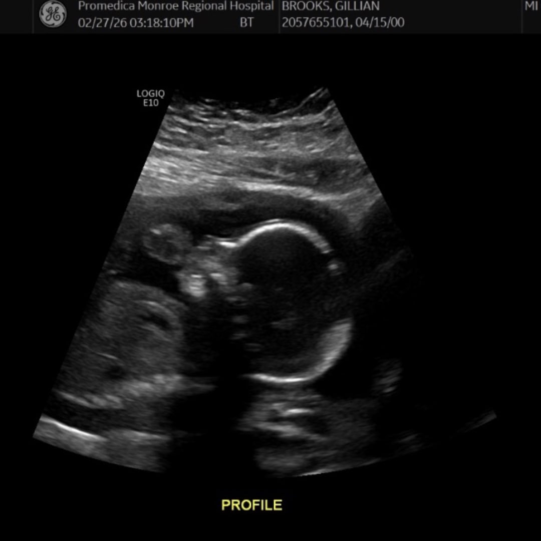 Photo shared by Gillian for their Babylist baby registry.