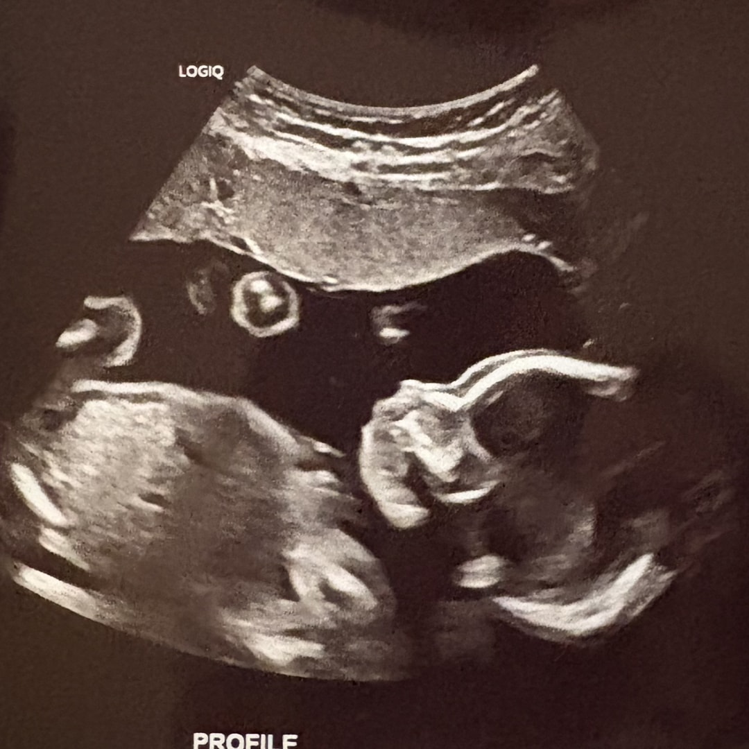 Photo shared by Abby for their Babylist baby registry.
