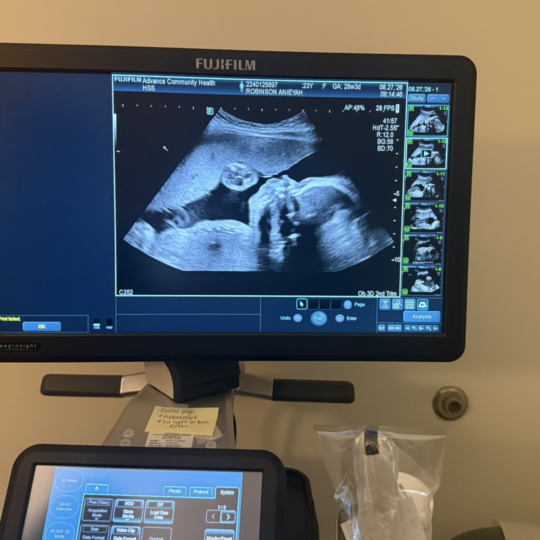 Photo shared by Anieyah for their Babylist baby registry.