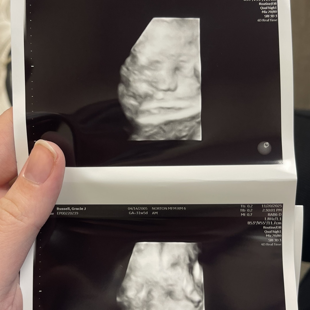 Photo shared by Gracie for their Babylist baby registry.