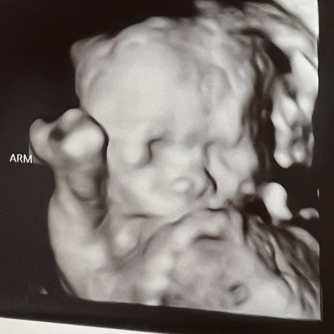 Photo shared by Elena for their Babylist baby registry.