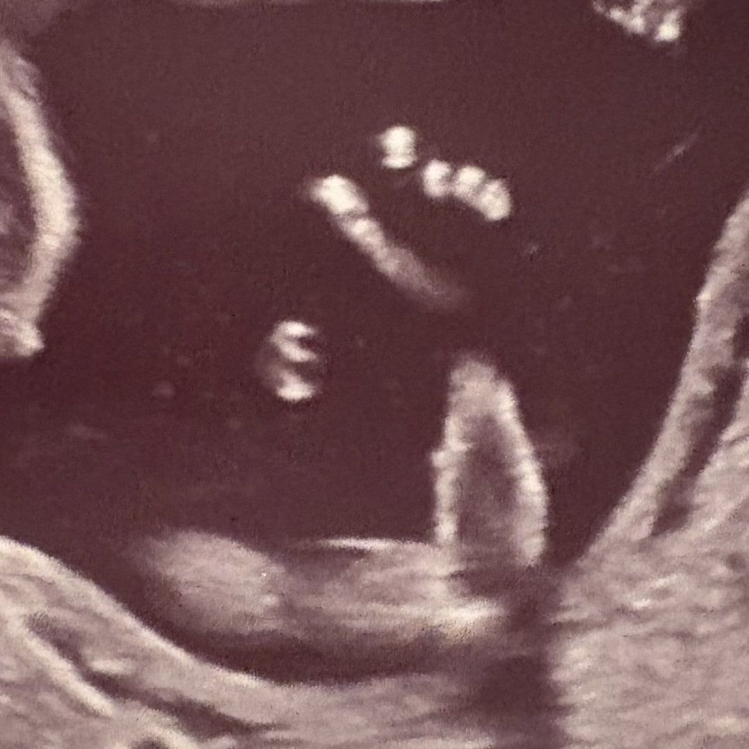 Photo shared by Grace for their Babylist baby registry.