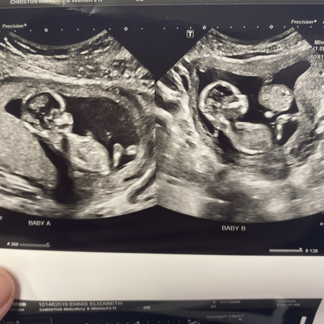 Photo shared by Elizabeth for their Babylist baby registry.