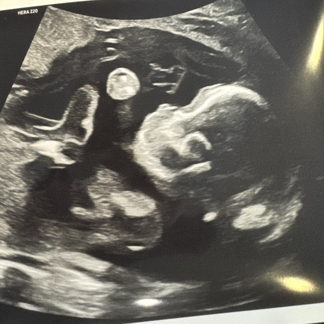 Photo shared by Gabrielle for their Babylist baby registry.