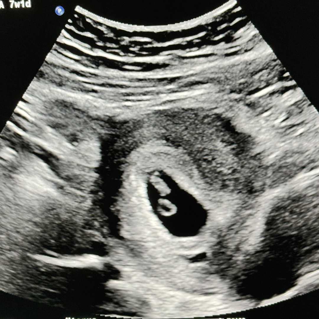 Photo shared by Daniela for their Babylist baby registry.