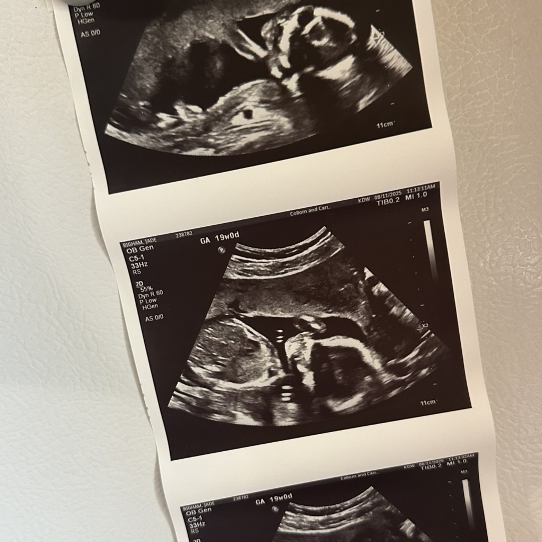 Photo shared by Jade for their Babylist baby registry.