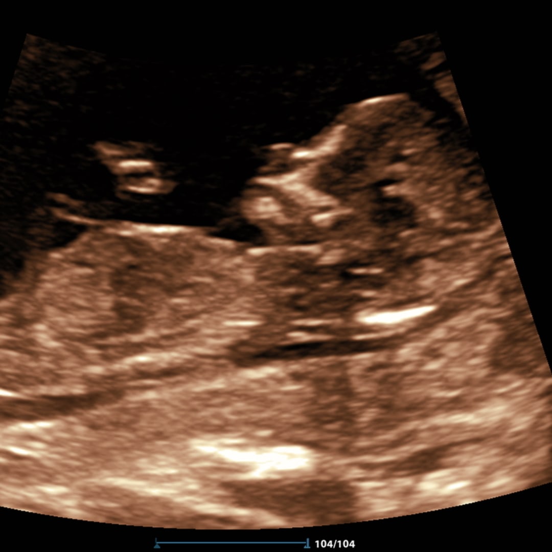 Photo shared by Joanna for their Babylist baby registry.