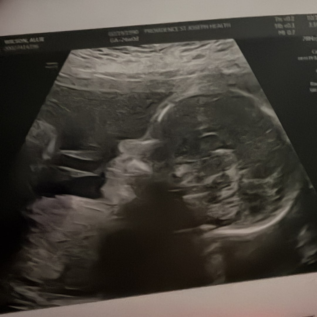 Photo shared by Allie for their Babylist baby registry.