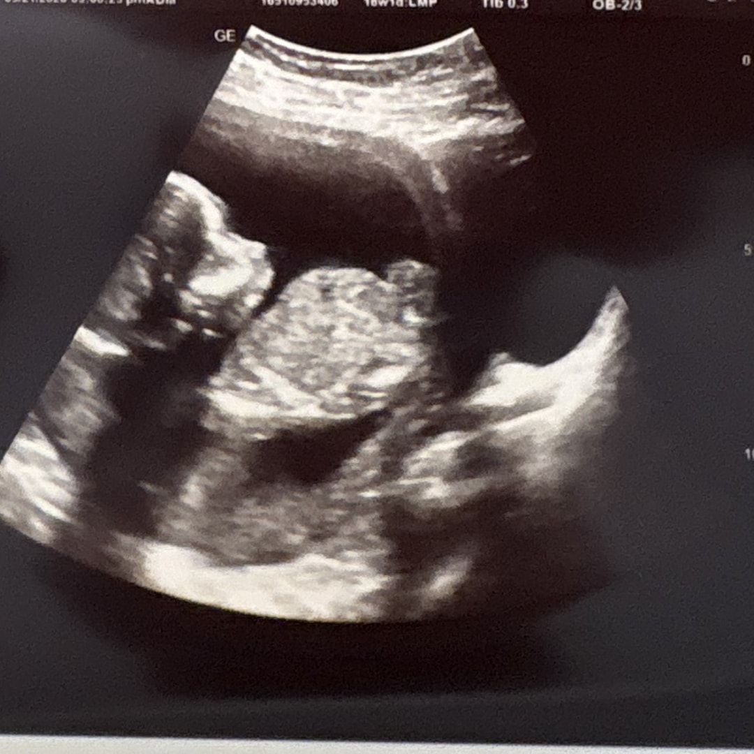 Photo shared by Mackenzie for their Babylist baby registry.