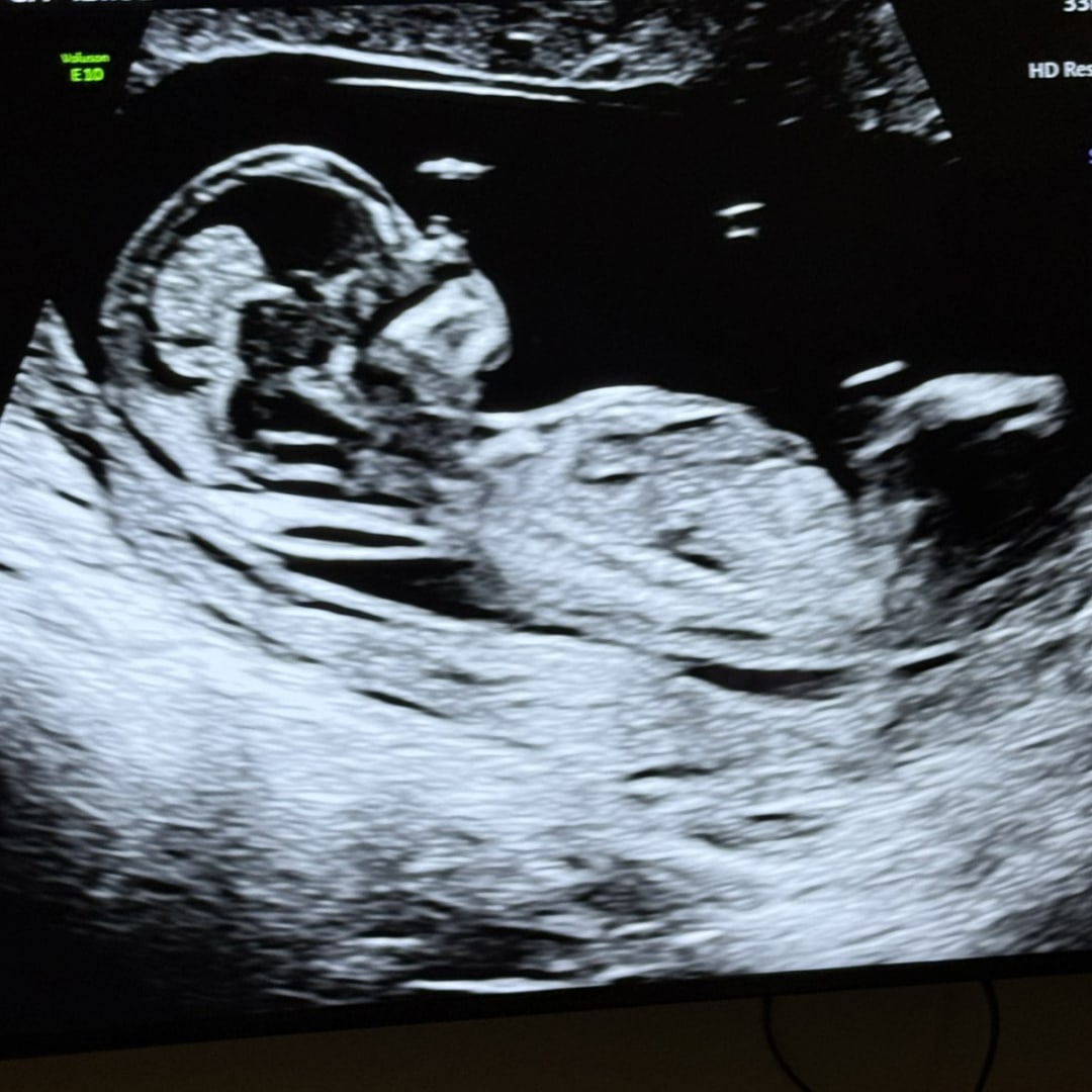 Photo shared by Mallory for their Babylist baby registry.