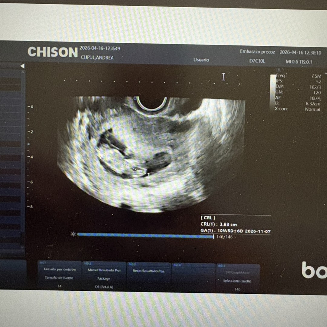 Photo shared by Robin for their Babylist baby registry.