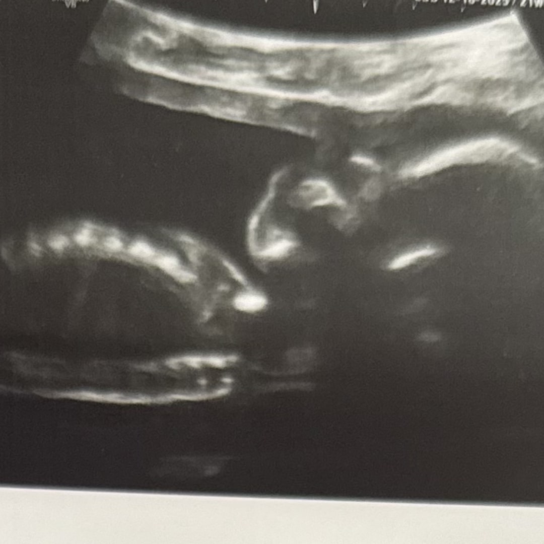 Photo shared by Stephanie for their Babylist baby registry.