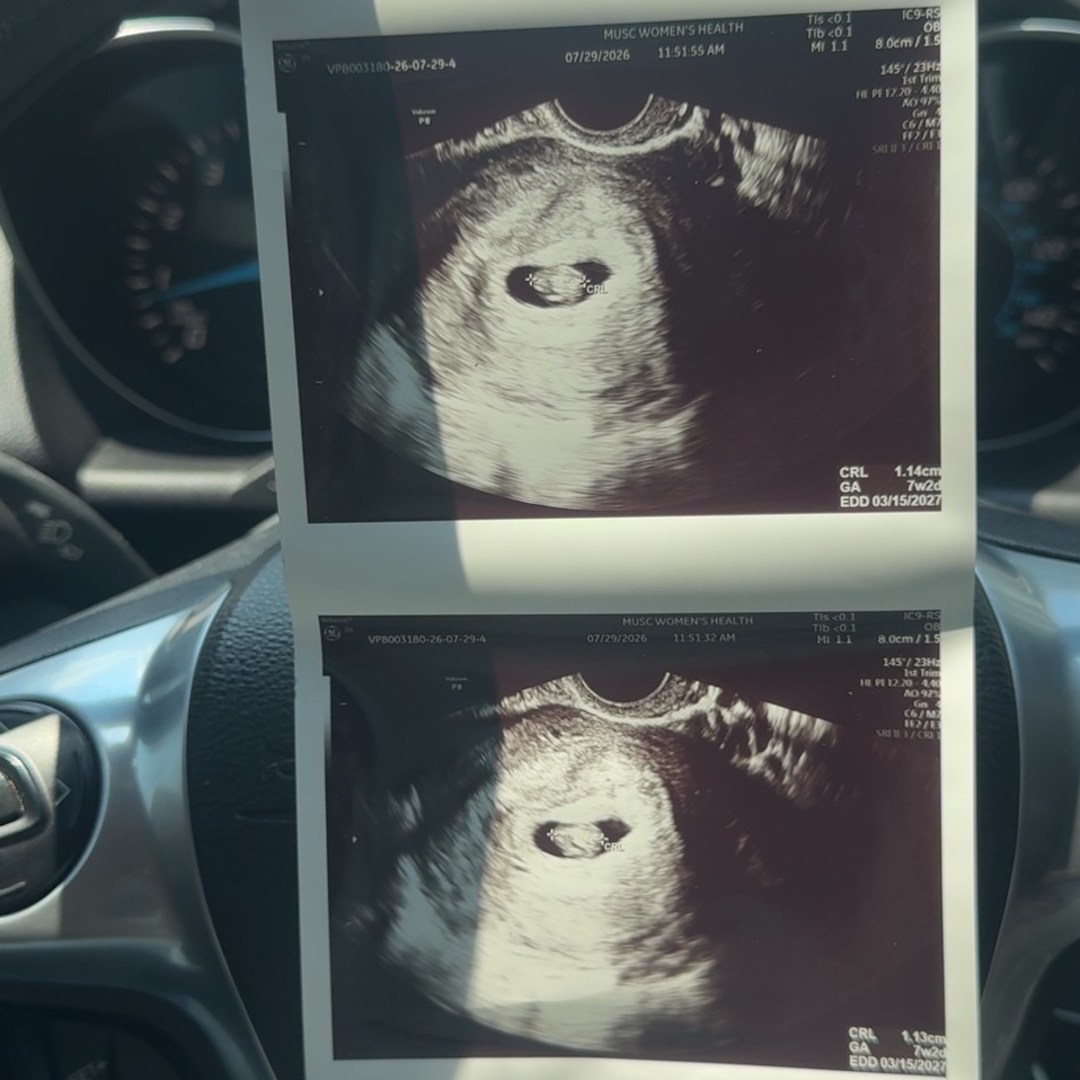 Photo shared by Chakara for their Babylist baby registry.