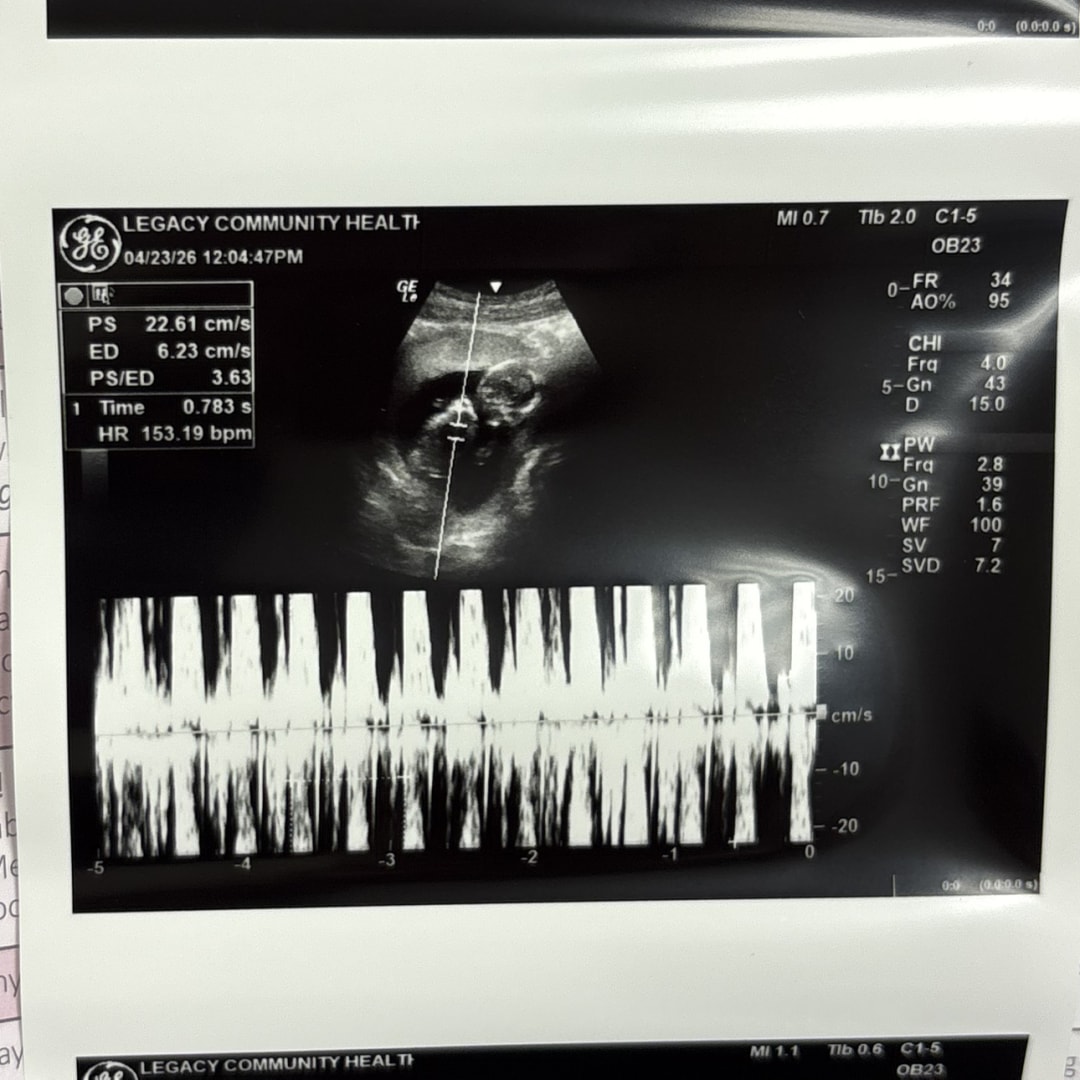 Photo shared by Makenzzi for their Babylist baby registry.