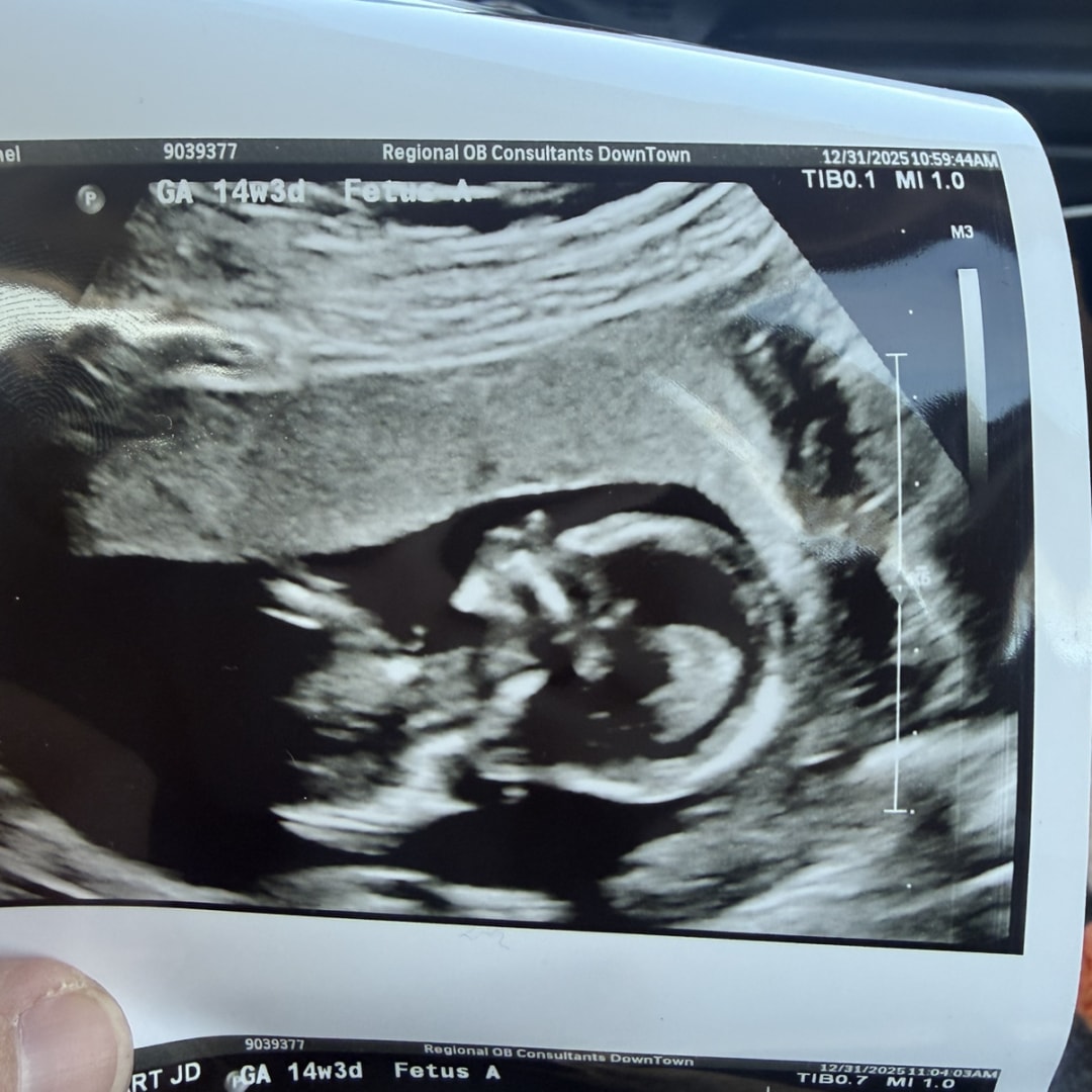 Photo shared by Rachel for their Babylist baby registry.