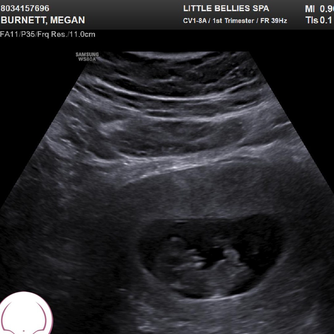 Photo shared by Megan for their Babylist baby registry.