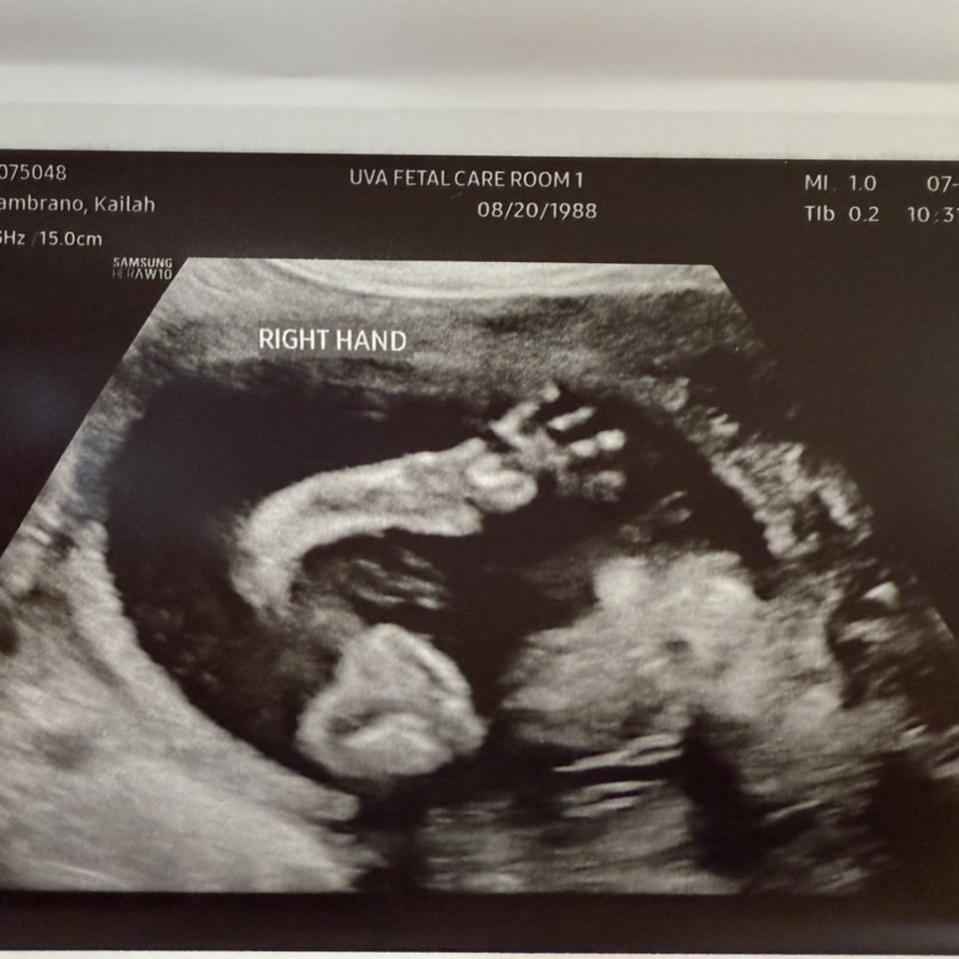 Photo shared by Kailah for their Babylist baby registry.