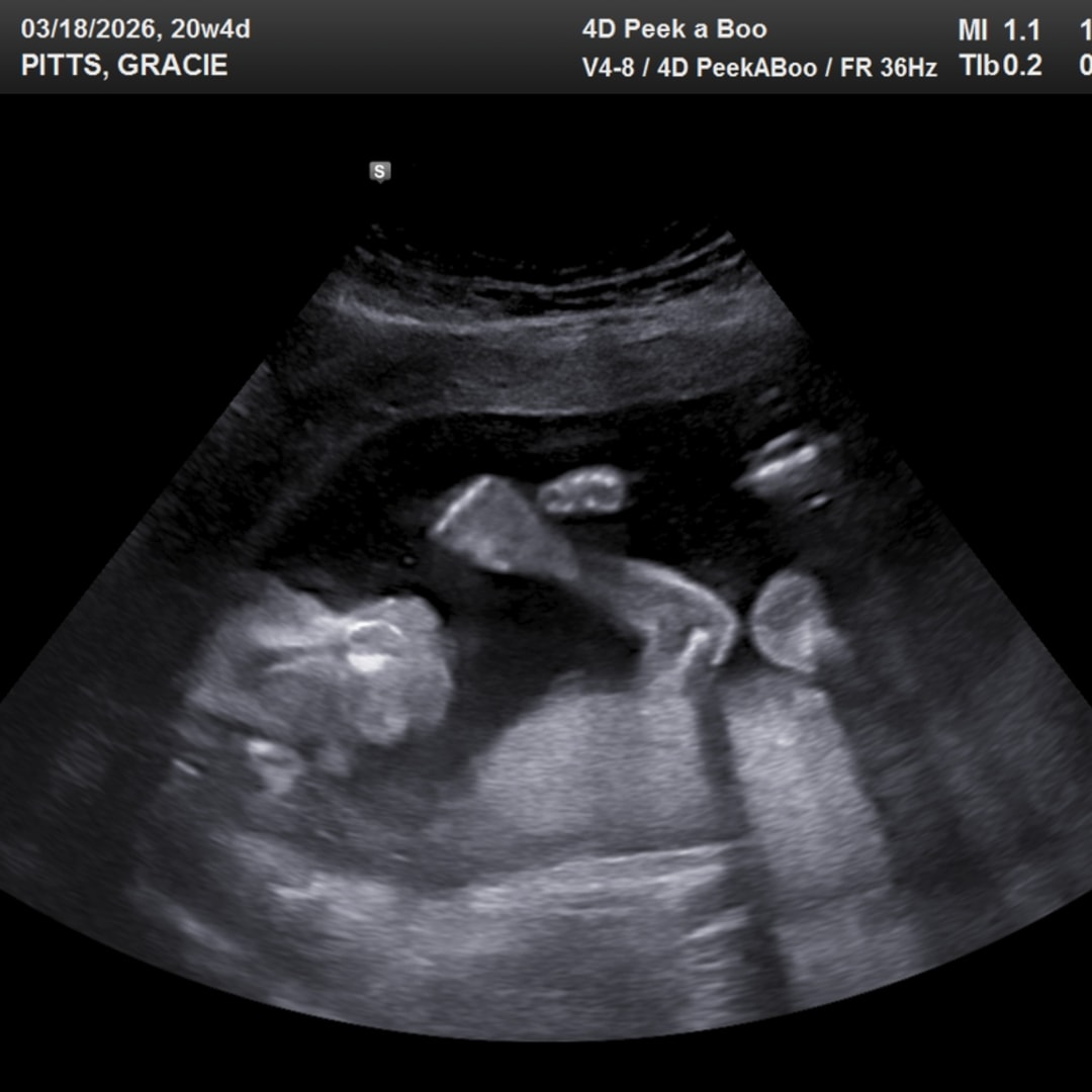 Photo shared by Gracie for their Babylist baby registry.