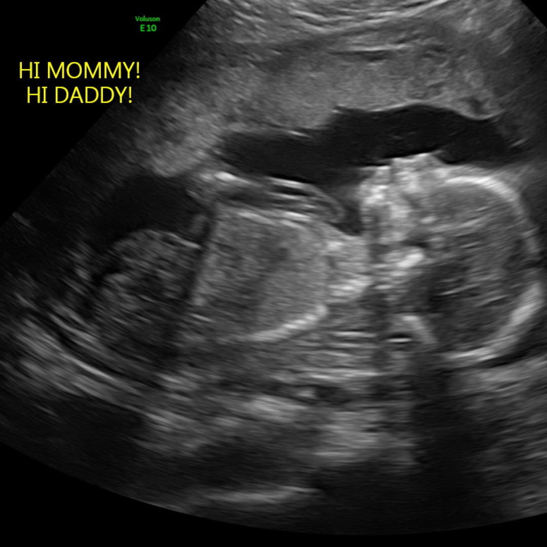 Photo shared by Lucero for their Babylist baby registry.