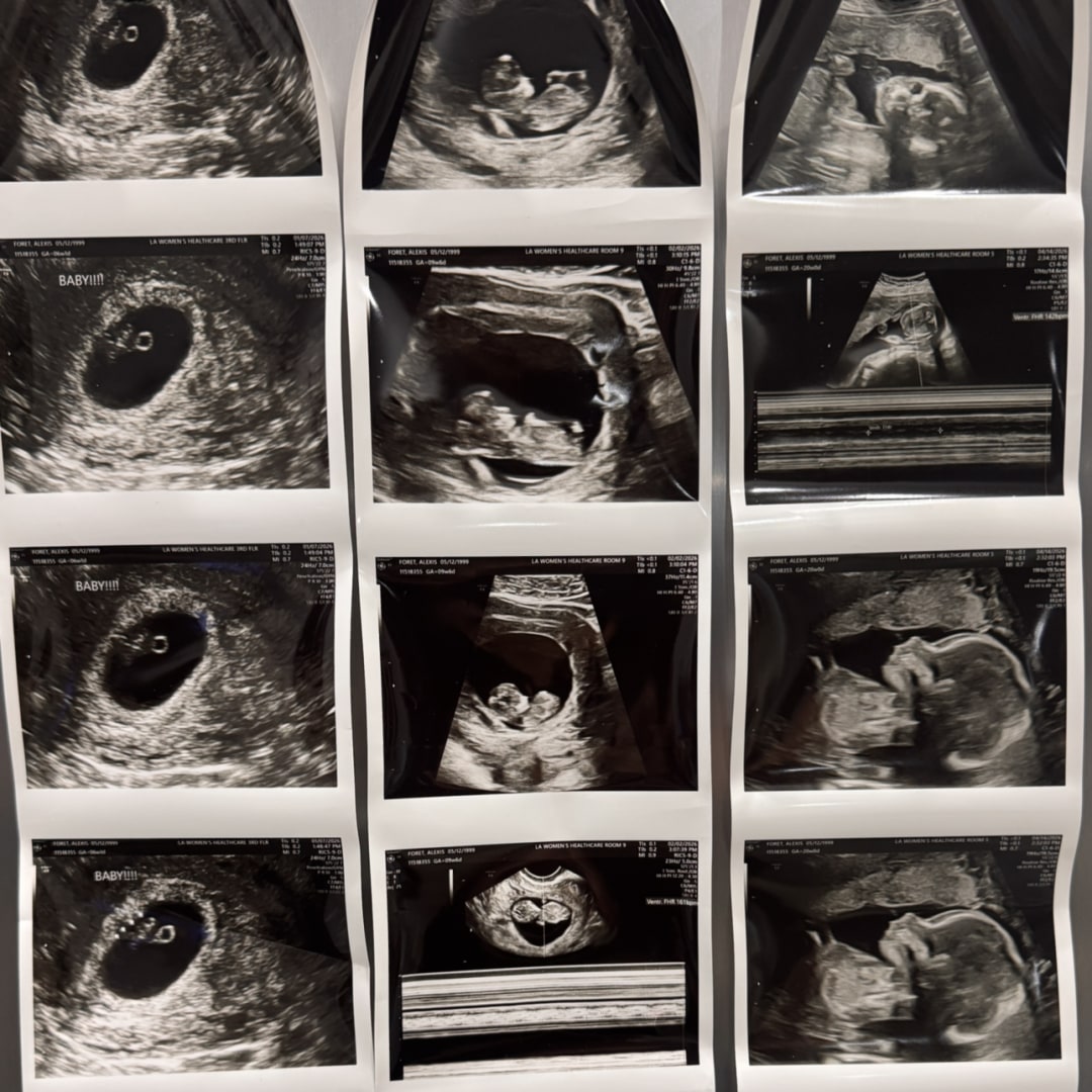 Photo shared by Alexis for their Babylist baby registry.