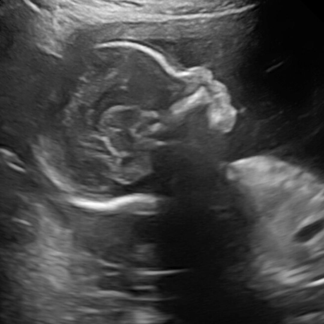 Photo shared by Katherine & Juan for their Babylist baby registry.