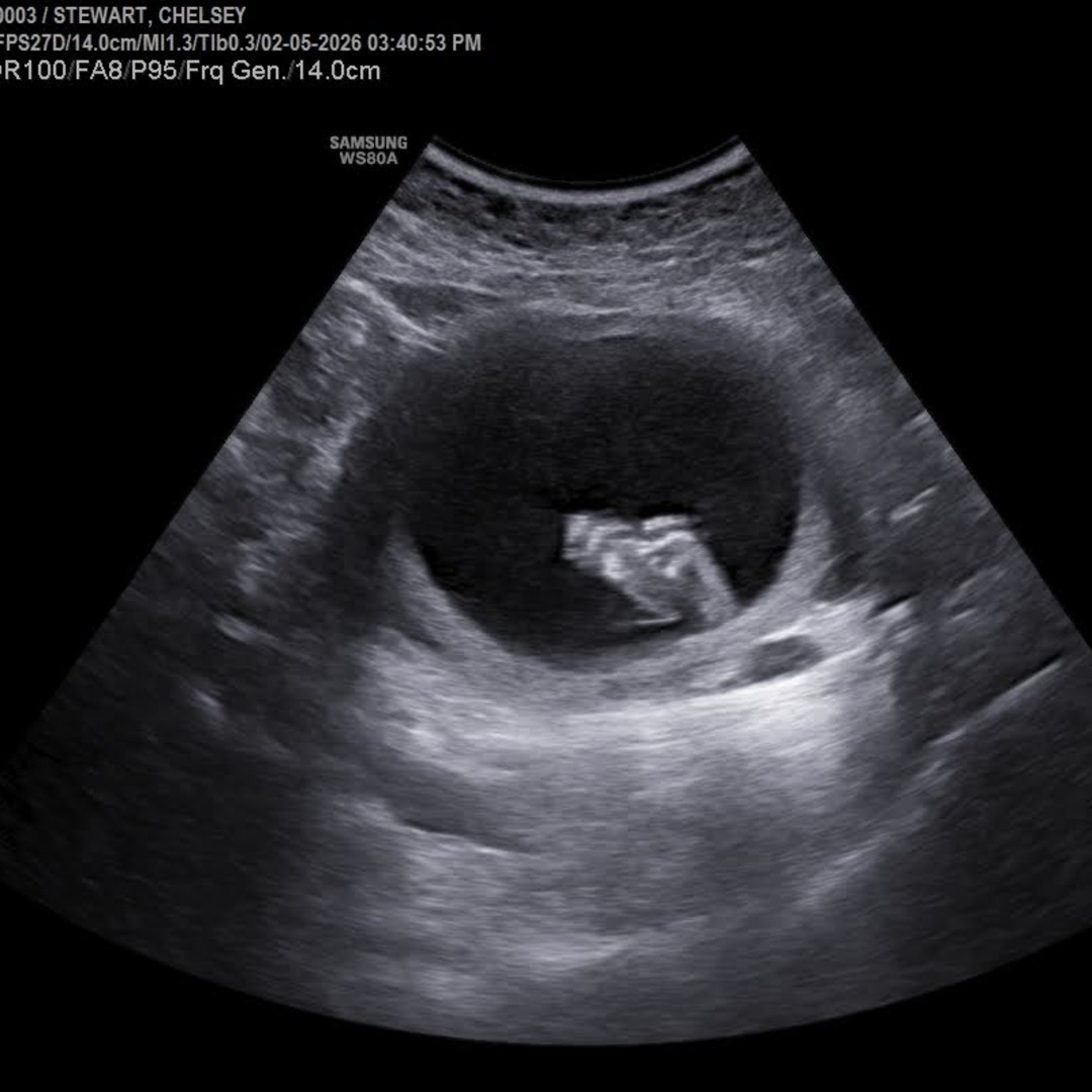 Photo shared by Justin for their Babylist baby registry.