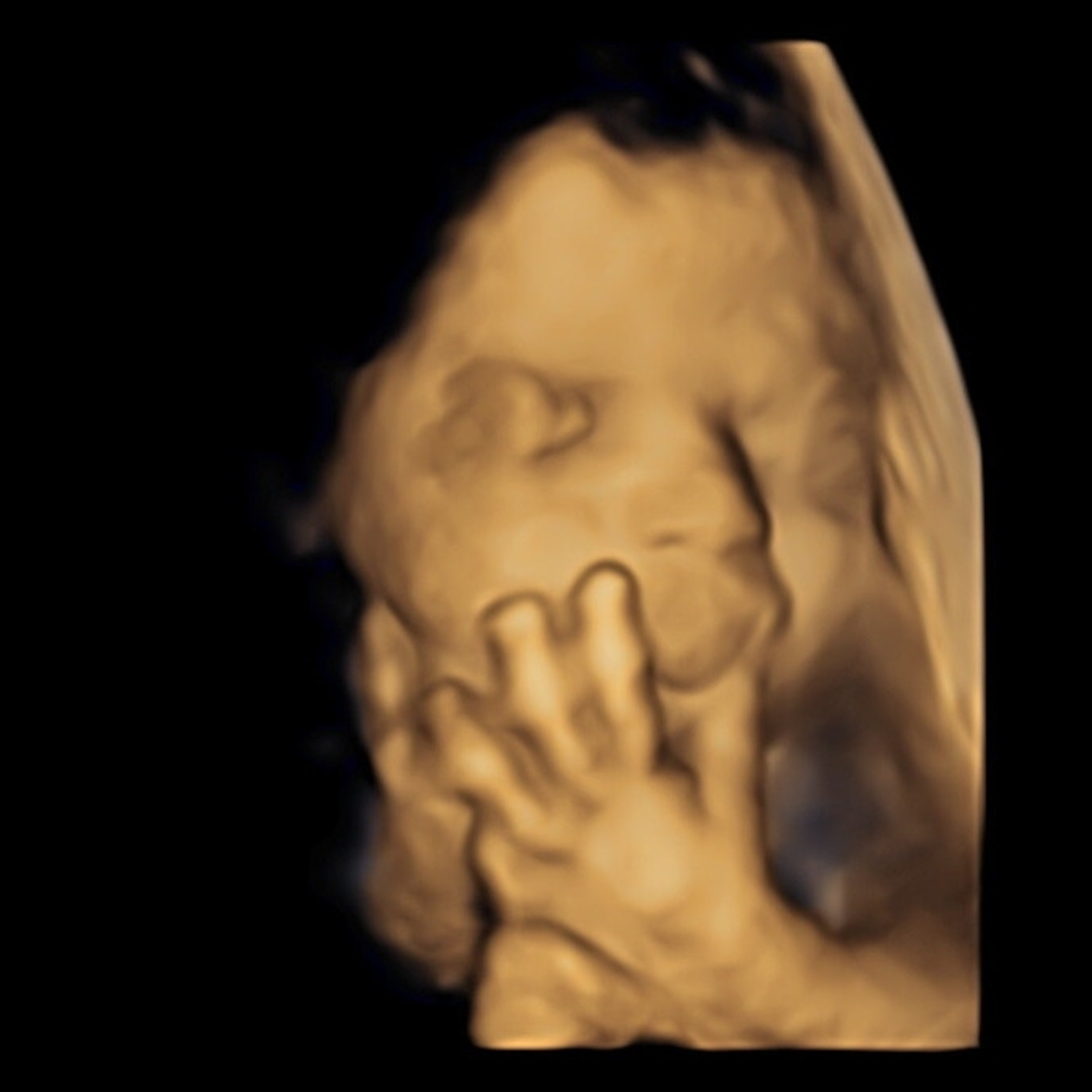 Photo shared by Kristen for their Babylist baby registry.