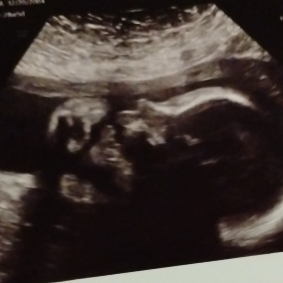Photo shared by Laura for their Babylist baby registry.