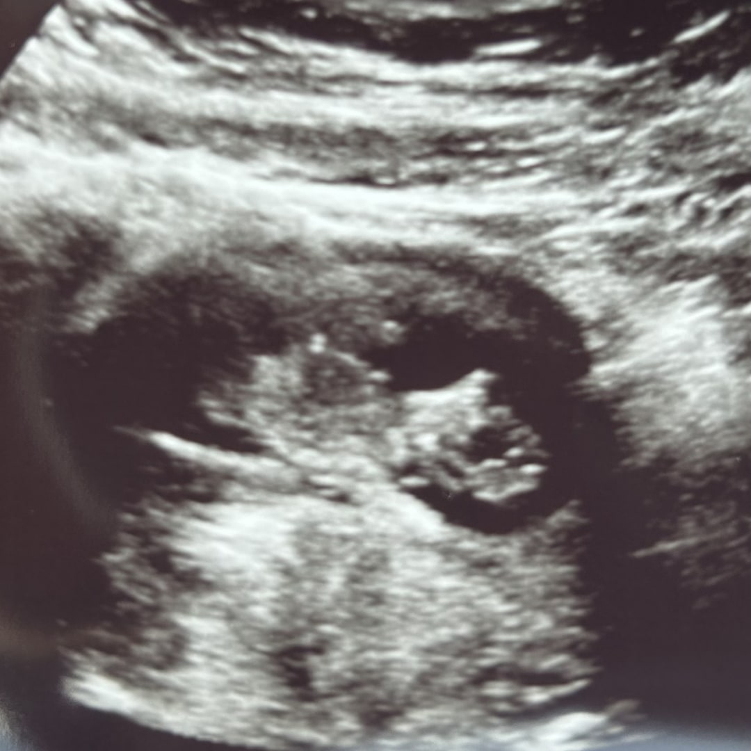 Photo shared by Hannah for their Babylist baby registry.