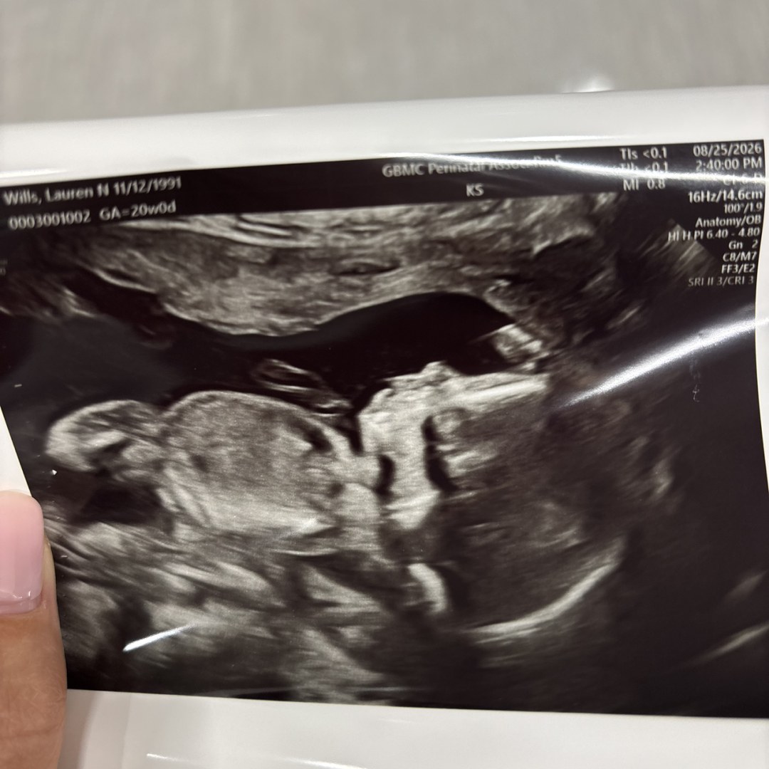 Photo shared by Lauren for their Babylist baby registry.