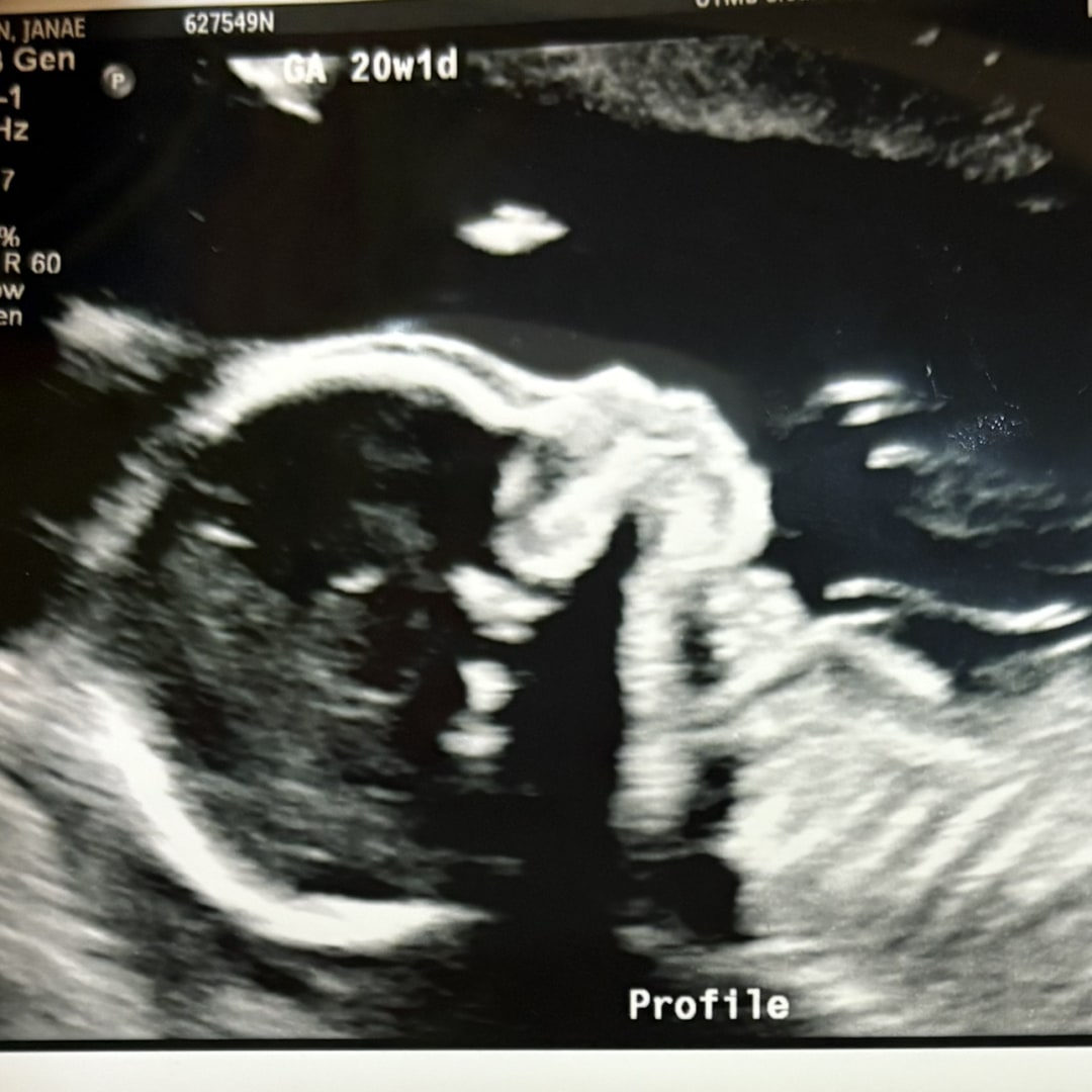 Photo shared by Janae for their Babylist baby registry.