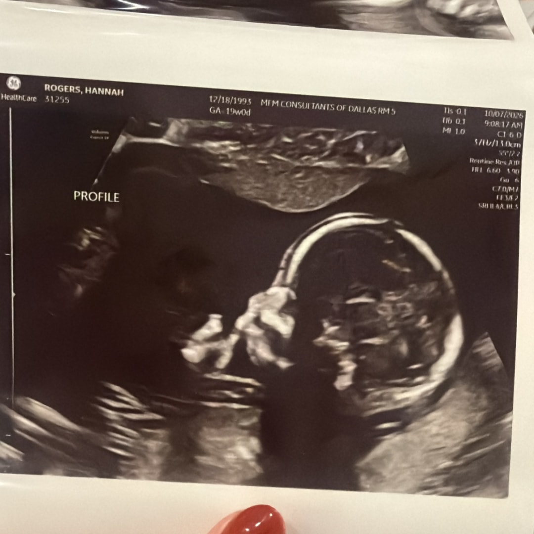 Photo shared by Hannah for their Babylist baby registry.