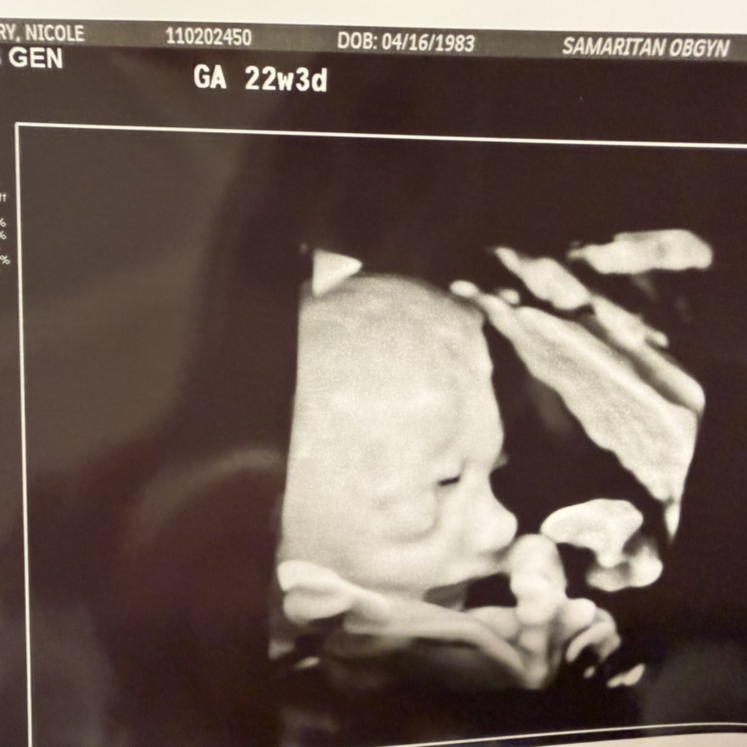 Photo shared by Nicole for their Babylist baby registry.