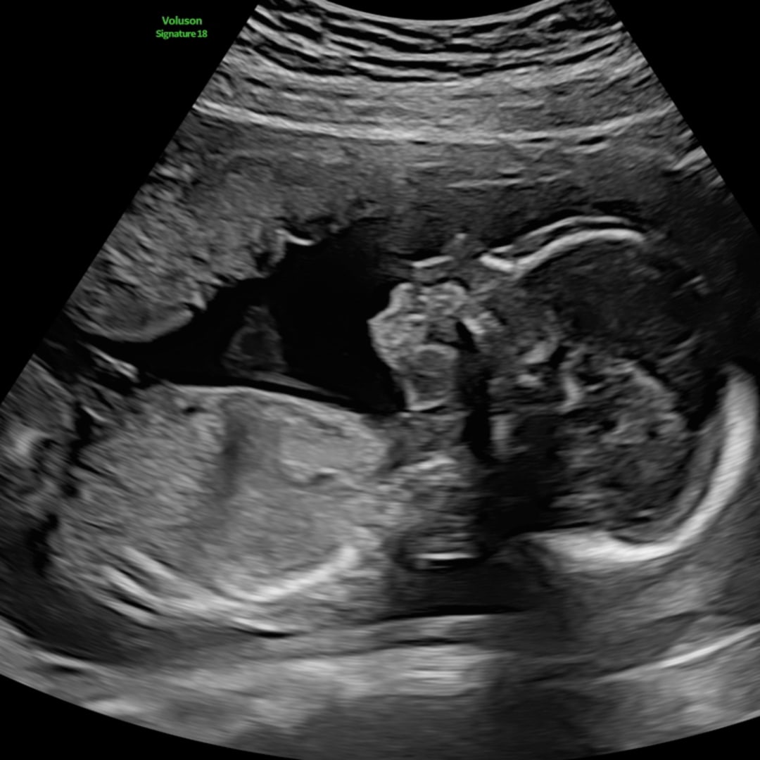 Photo shared by Ericka for their Babylist baby registry.