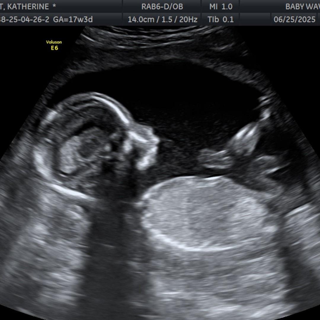 Photo shared by Katherine & Len for their Babylist baby registry.