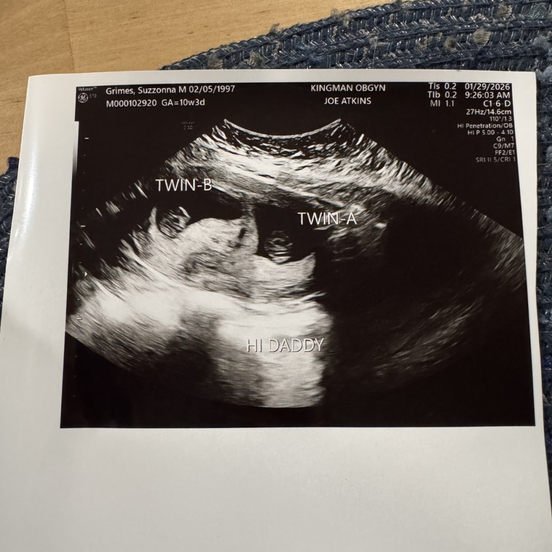 Photo shared by Suzzonna for their Babylist baby registry.