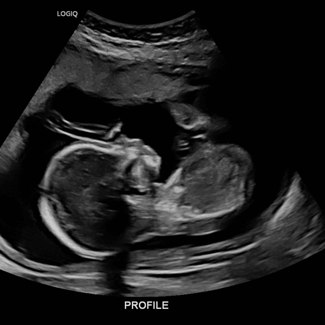 Photo shared by Kirsten for their Babylist baby registry.