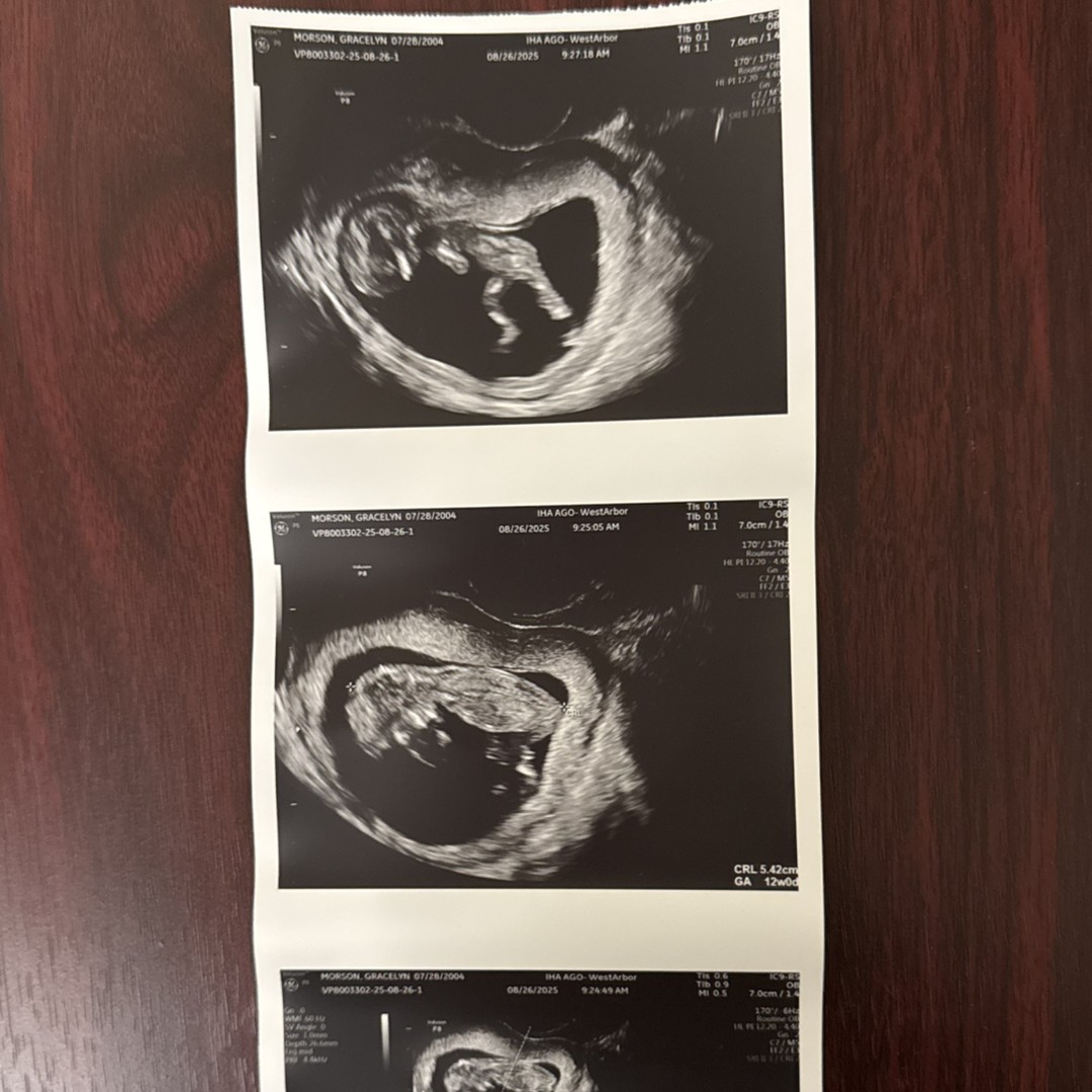 Photo shared by Grace for their Babylist baby registry.