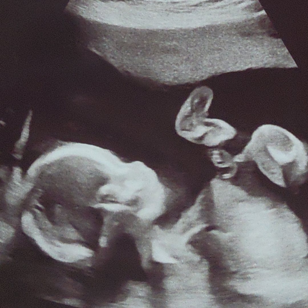 Photo shared by Alyssa for their Babylist baby registry.